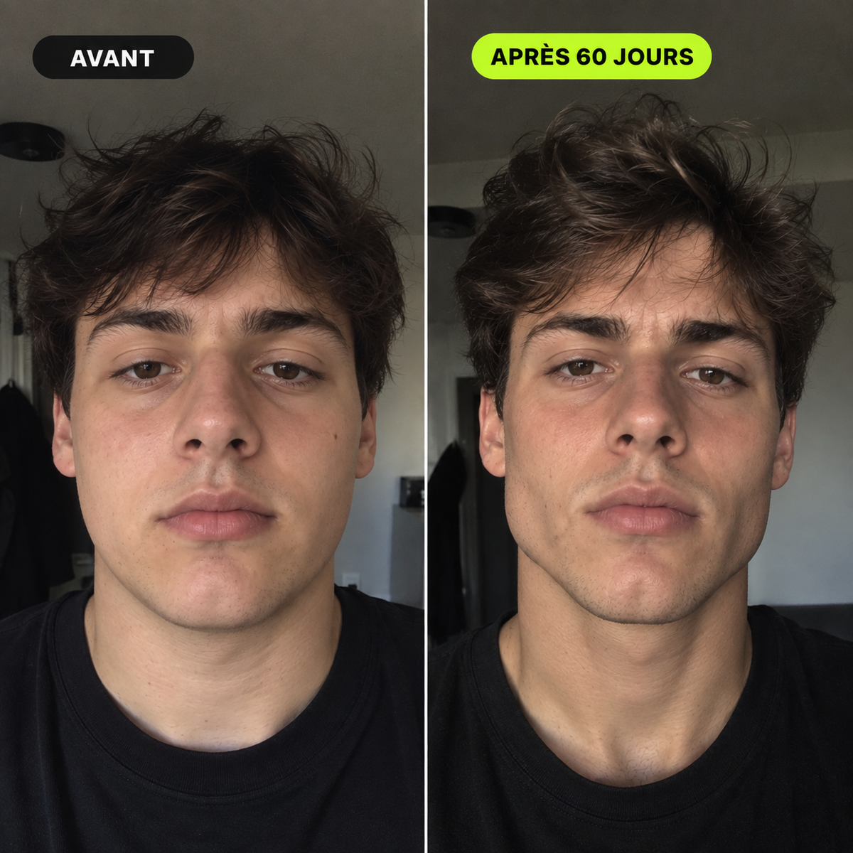 VEYRO — Entraîneur de mâchoire
