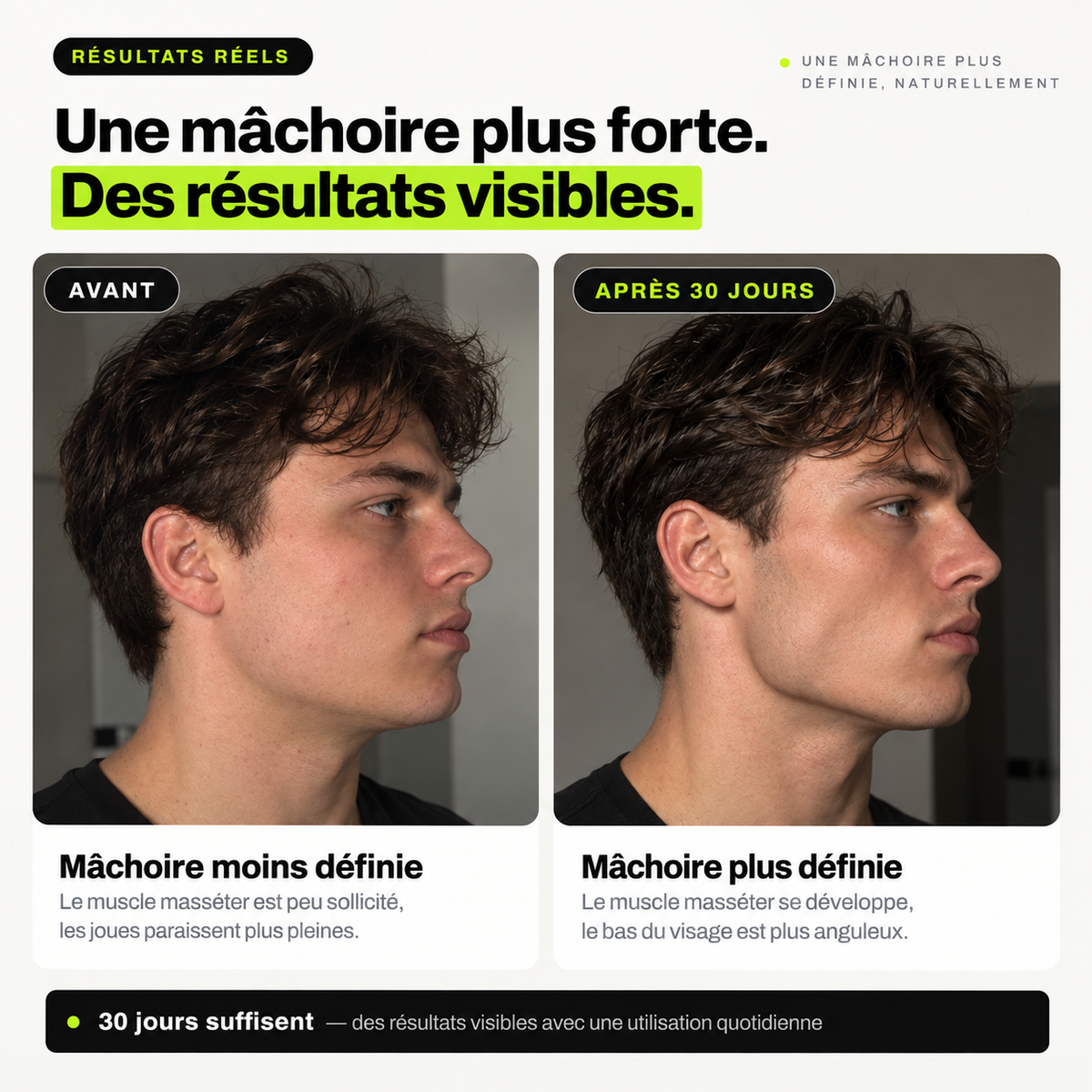 VEYRO — Entraîneur de mâchoire
